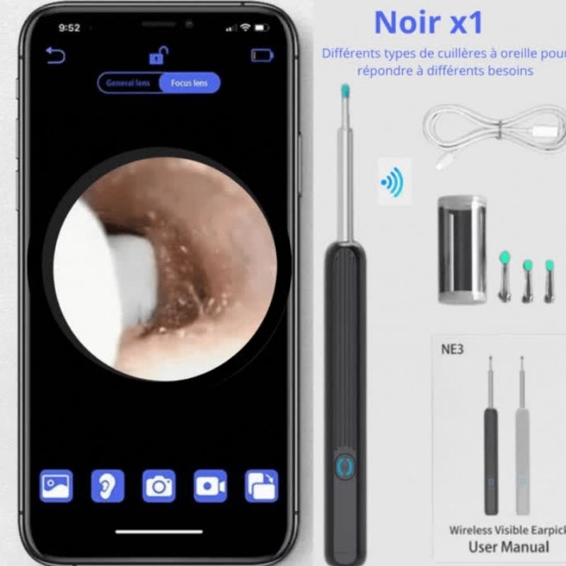 Nettoyant Oreille Otoscope, Camera Oreille D'élimination Du Cérumen | EarexPro™